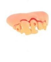 Гнилые зубы с дырками